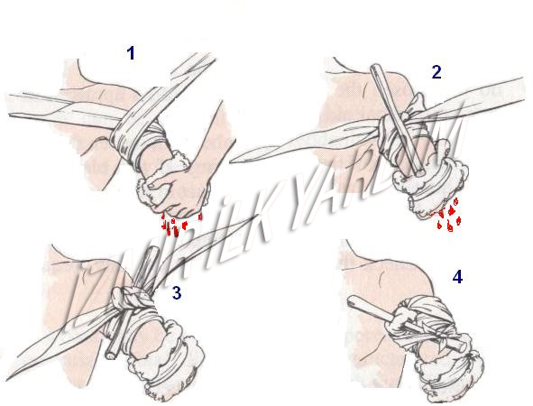kanama-turnike-boğucu-sargı